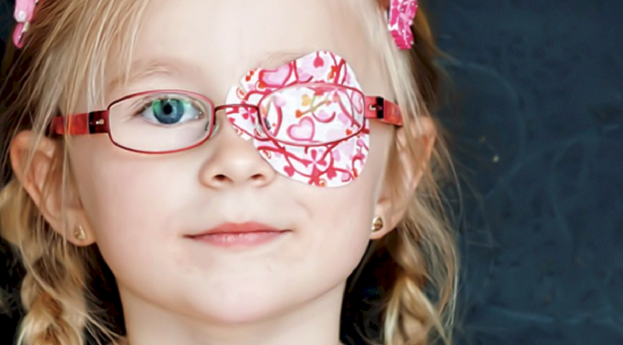 Деточки очки. Дисбинокулярная амблиопия. Очки для косоглазия детские. Детские очки для зрения. Амблиопия очки.